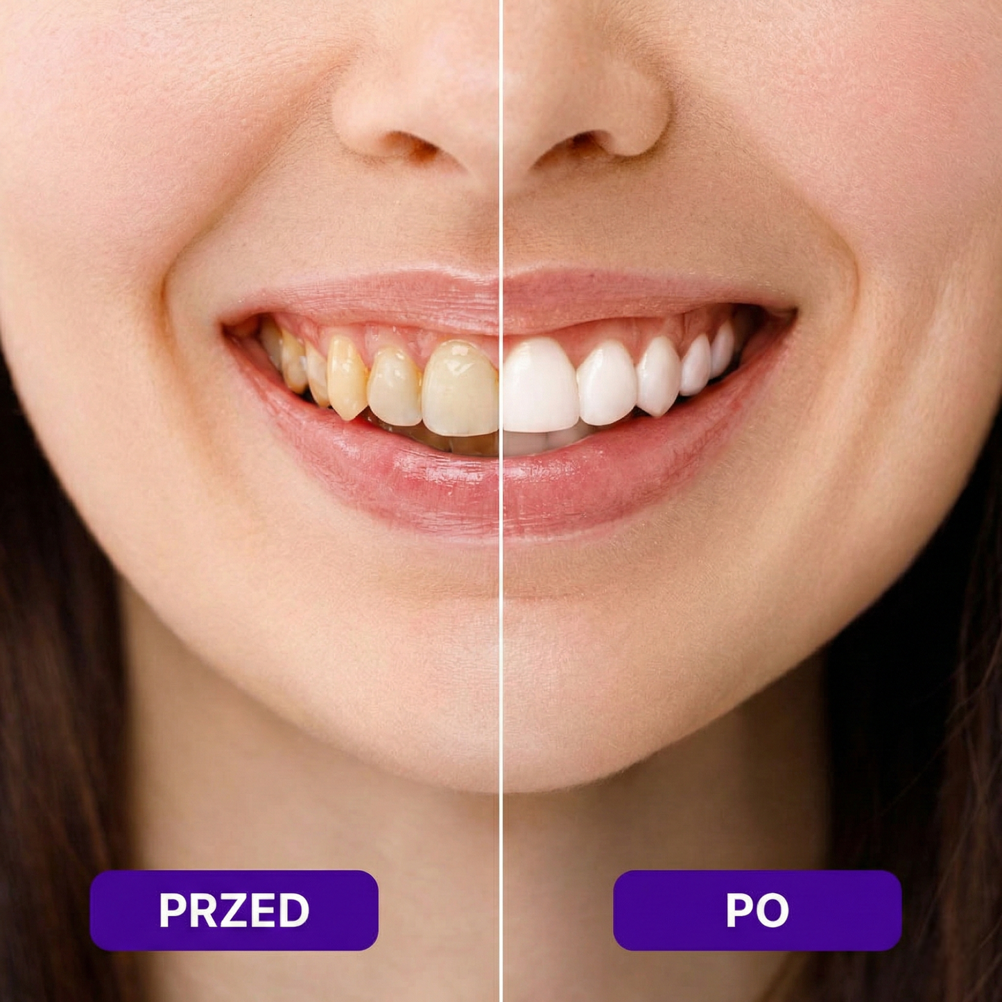 JasnyUsmiech™ - Paski Do Wybielania Zębów